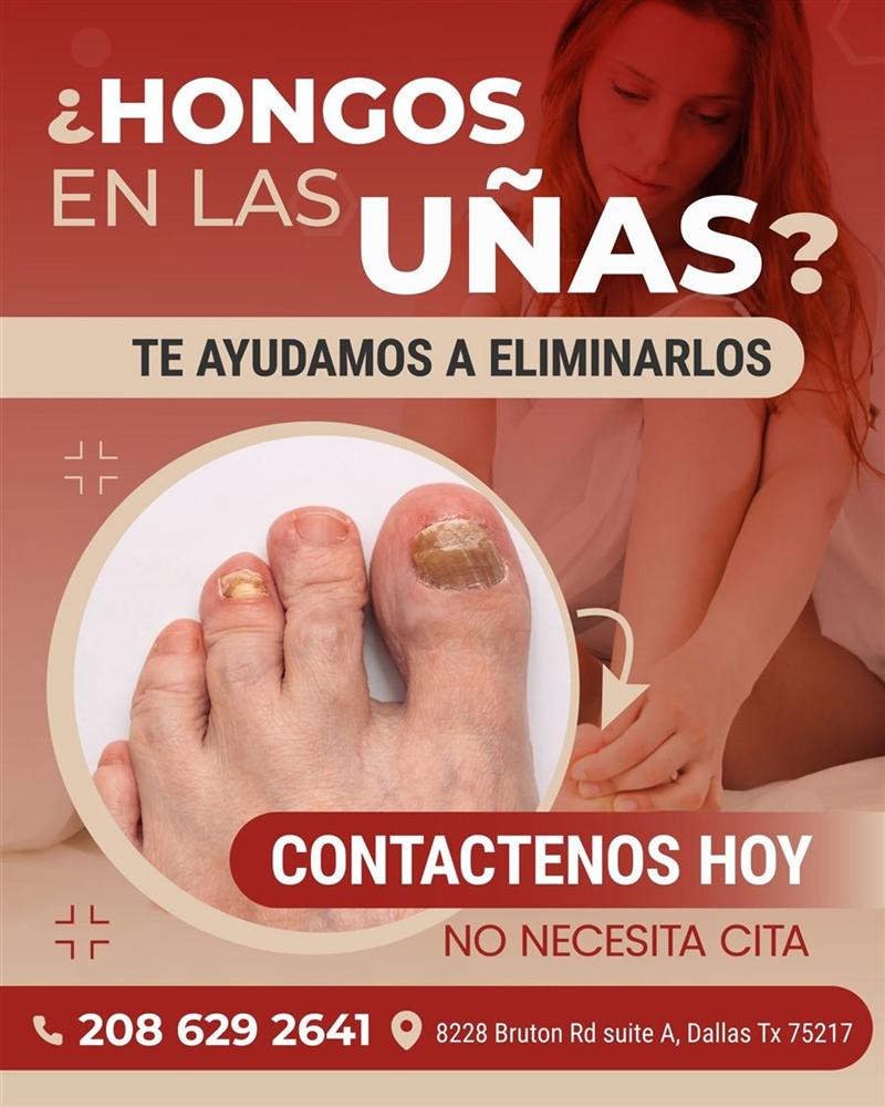 Promoción: tratamiento para eliminar hongos en las uñas, sin cita
